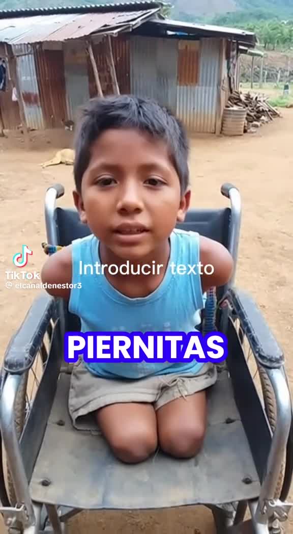 Este vídeo de Emiliano, un niño sin piernas ni brazos que pide ayuda para llegar a 5 millones de visualizaciones y conseguir sus prótesis, no es real: tiene indicios de haber sido creado con IA