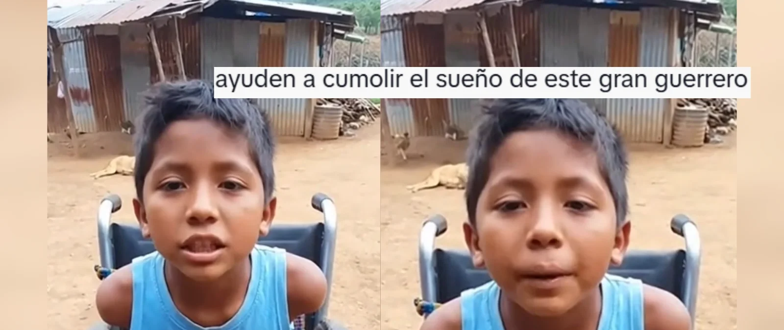 Este vídeo de Emiliano, un niño sin piernas ni brazos que pide ayuda para llegar a 5 millones de visualizaciones y conseguir sus prótesis, no es real: tiene indicios de haber sido creado con IA