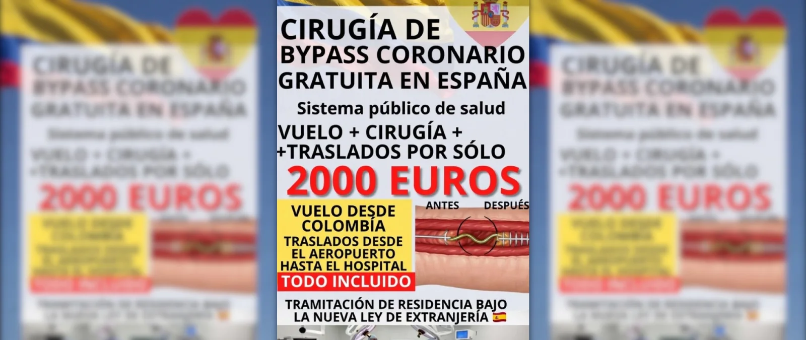 Cuidado con la oferta de una cirugía de bypass coronario “con cargo al sistema público español”: la asistencia sanitaria gratuita es para residentes en España
