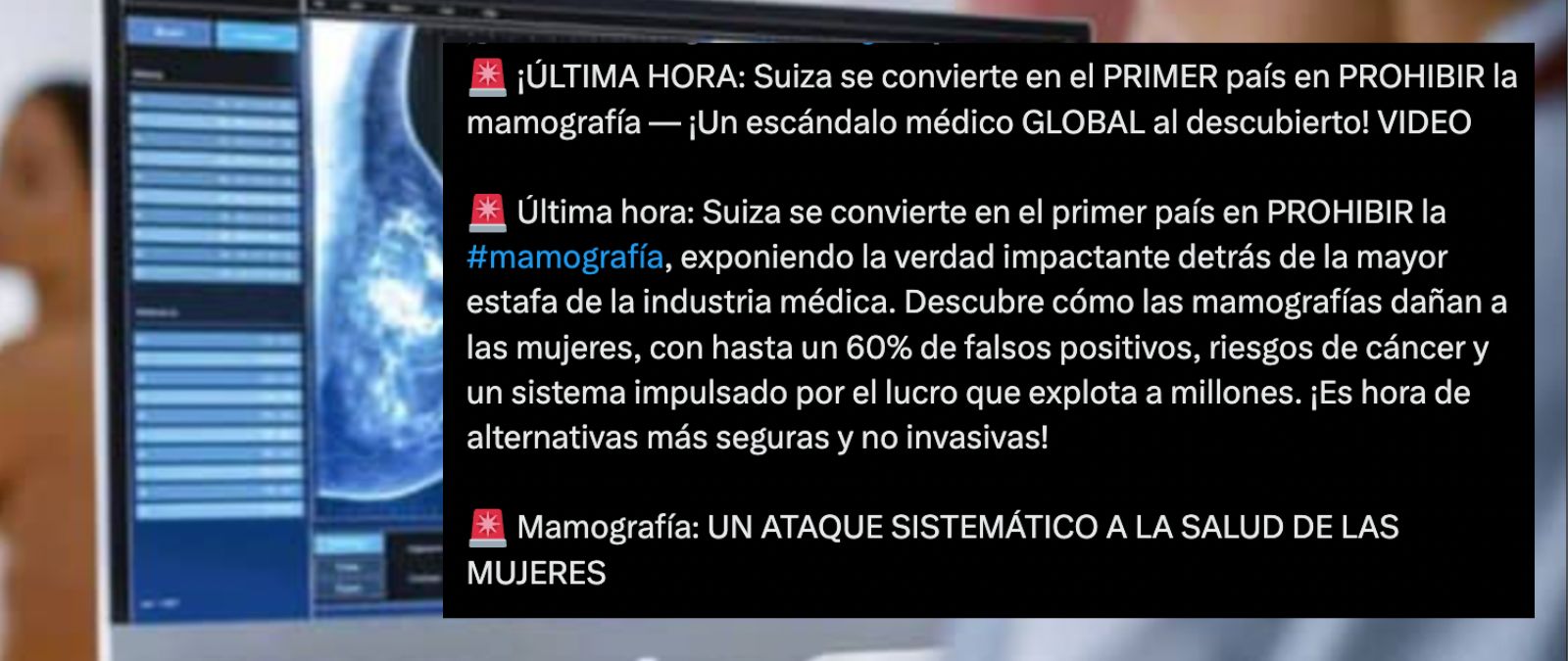 Suiza no ha prohibido las mamografías, a abril de 2026