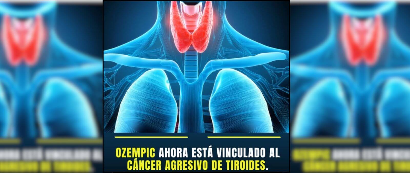 Qué sabemos sobre la relación entre Ozempic y el riesgo de cáncer de tiroides a septiembre de 2026